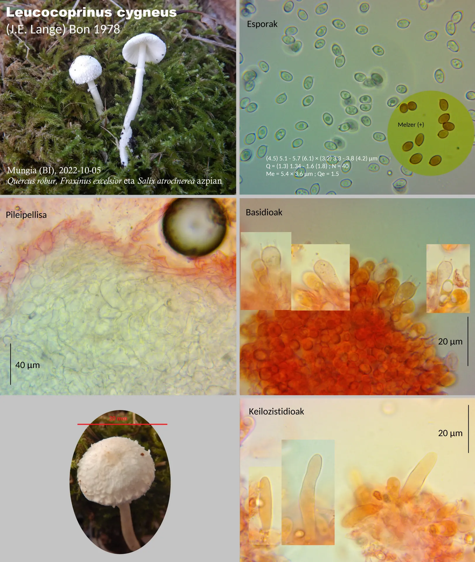 Microscopía de Leucocoprinus cygneus